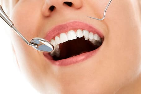Vrouw lacht bij de tandarts en heeft geen angst